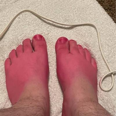 Fußbilder von Füßen - thumb