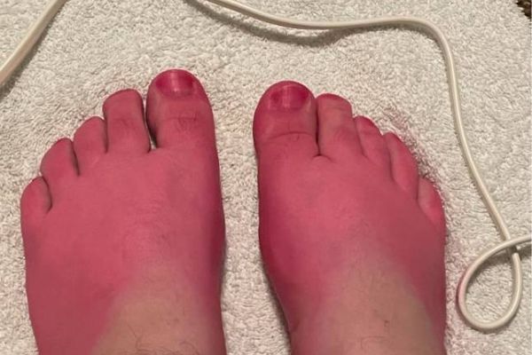 Fußbilder von Füßen