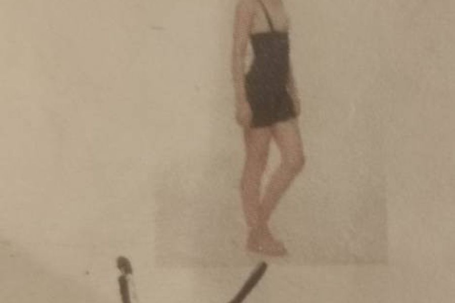 Liposuktion - Bild 1