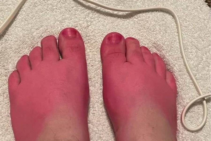 Fußbilder von Füßen - Bild 1